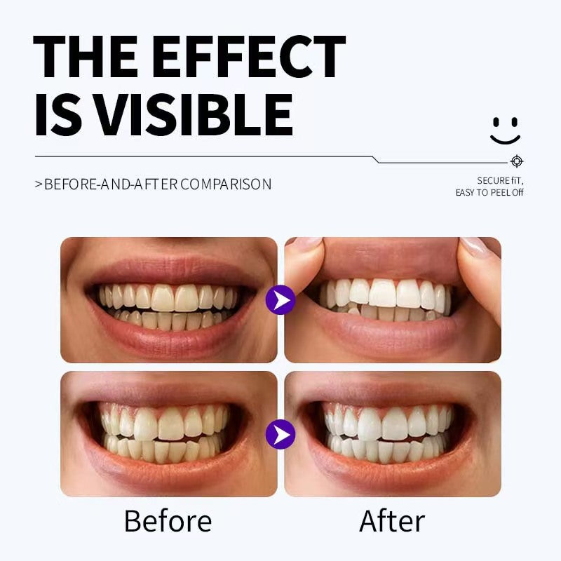 SmileGlow before and after comparison